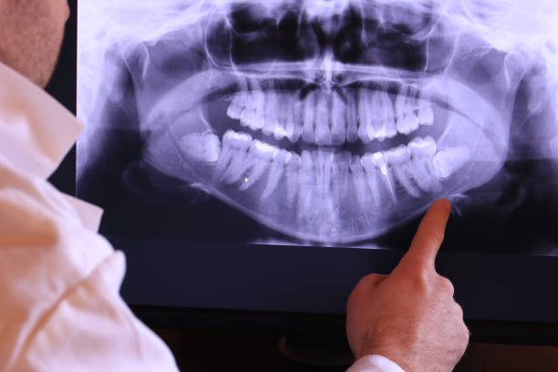 Best Emergency Dentist Near Me  in Warm Mineral Springs, FL